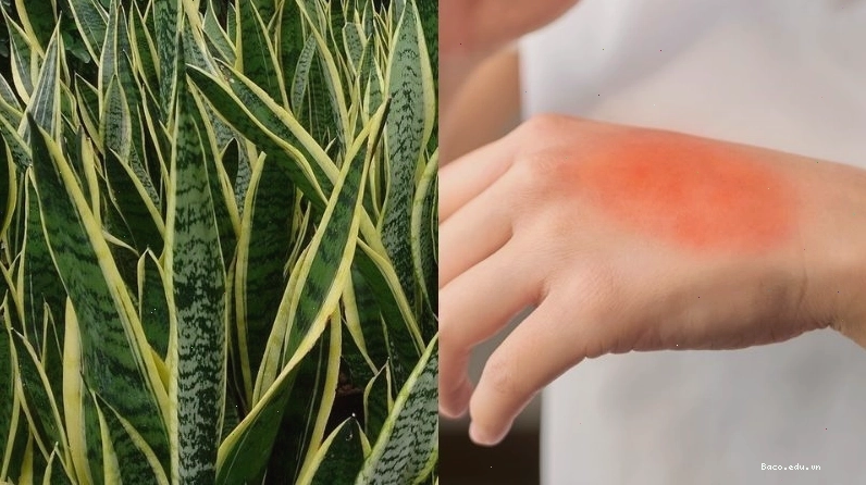 Cây lưỡi hổ còn có công dụng chữa các bệnh sâu răng, viêm tai giữa và trị bỏng