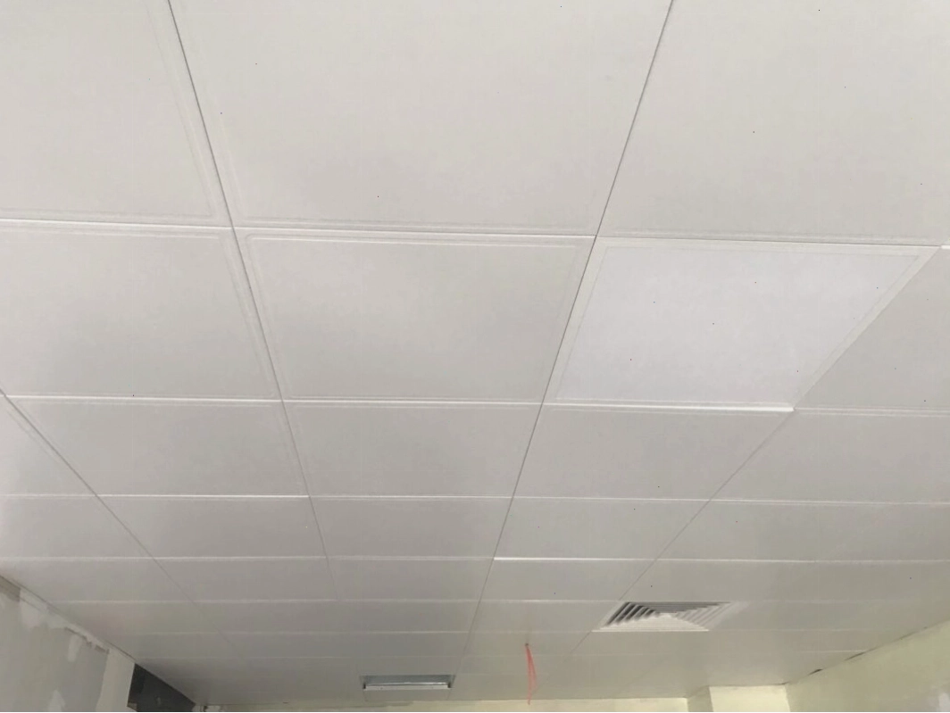 Hình ảnh thực tế trần nhôm clip-in tại Bệnh viện hữu nghị Việt - Xô